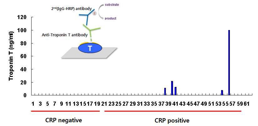 CRP negative와 positive 환자에서 direct ELISA를 이용한 Troponin T 농도 측정 분석 (B대학)