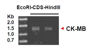 PCR을 이용해 증폭된 human CK-MB 유전자