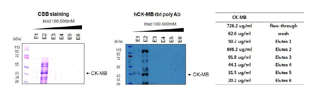 1mM IPTG로 induction된 CK-MB의 Ni-NTA bead binding과 fractionation 확인