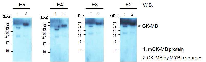 정제된 Anti-hCK-MB antibody의 western blotting을 통한 항원 검출력 확인