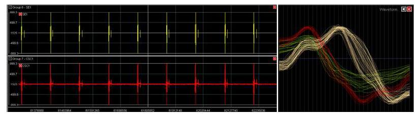 rat sciatic nerve에서 검출된 spike train과 그 waveform