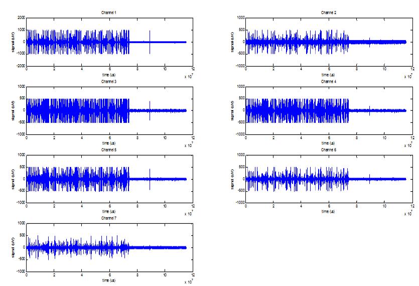 신경을 일부 절개해 나노와이어 전극을 삽입한 상태에서의 spontaneous signal 측정 결과