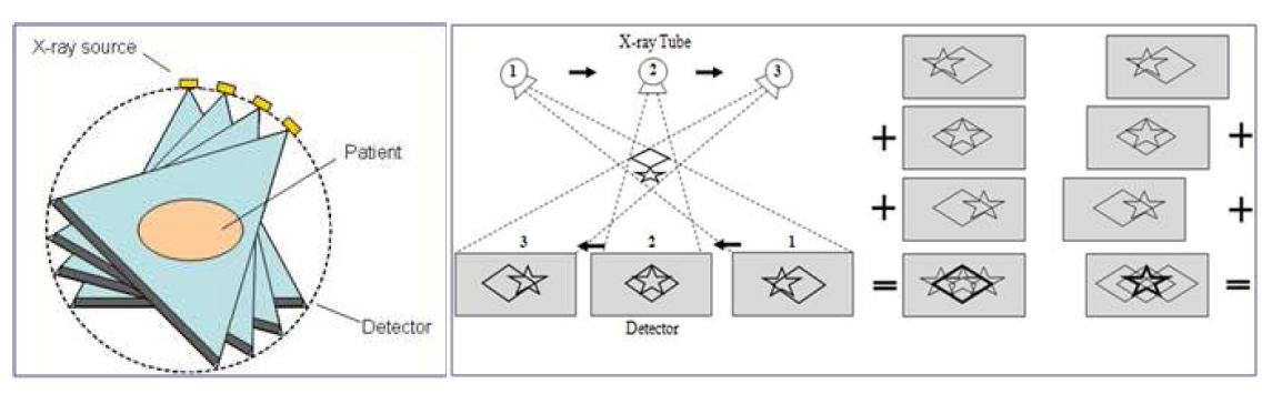 X-선 CT(좌) 및 엑스선 단층영상합성(우)에서의 투영데이터 수집