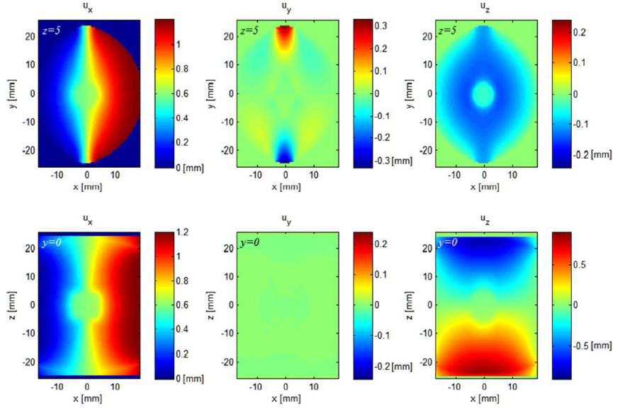 FEM으로 해석한 원통형 팬텀 내 변위 분포. z=5mm의 면(상), y=0mm의 면 (하)