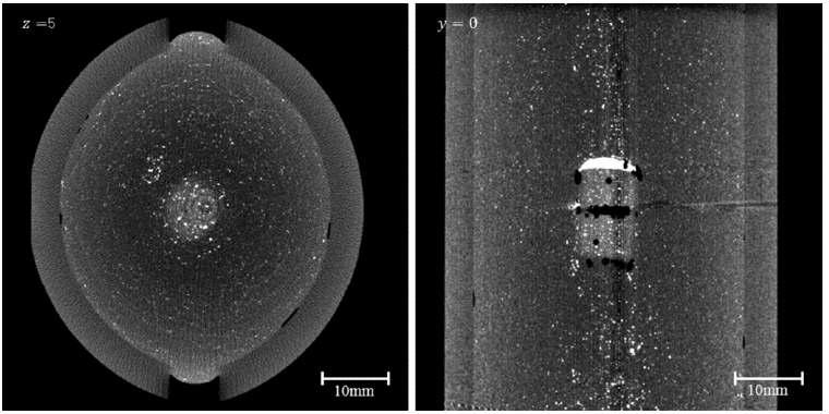 원통형 팬텀을 엑스선 단층촬영한 예. z=5mm의 면 (좌), y=0의 면 (우)