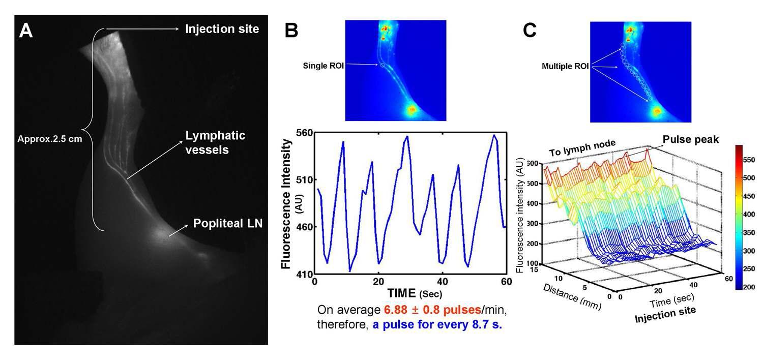 Indocyanine green과 근적외선 형광이미징 시스템을 통한 실시간 정량적 생체 내 림프액 흐름 측정
