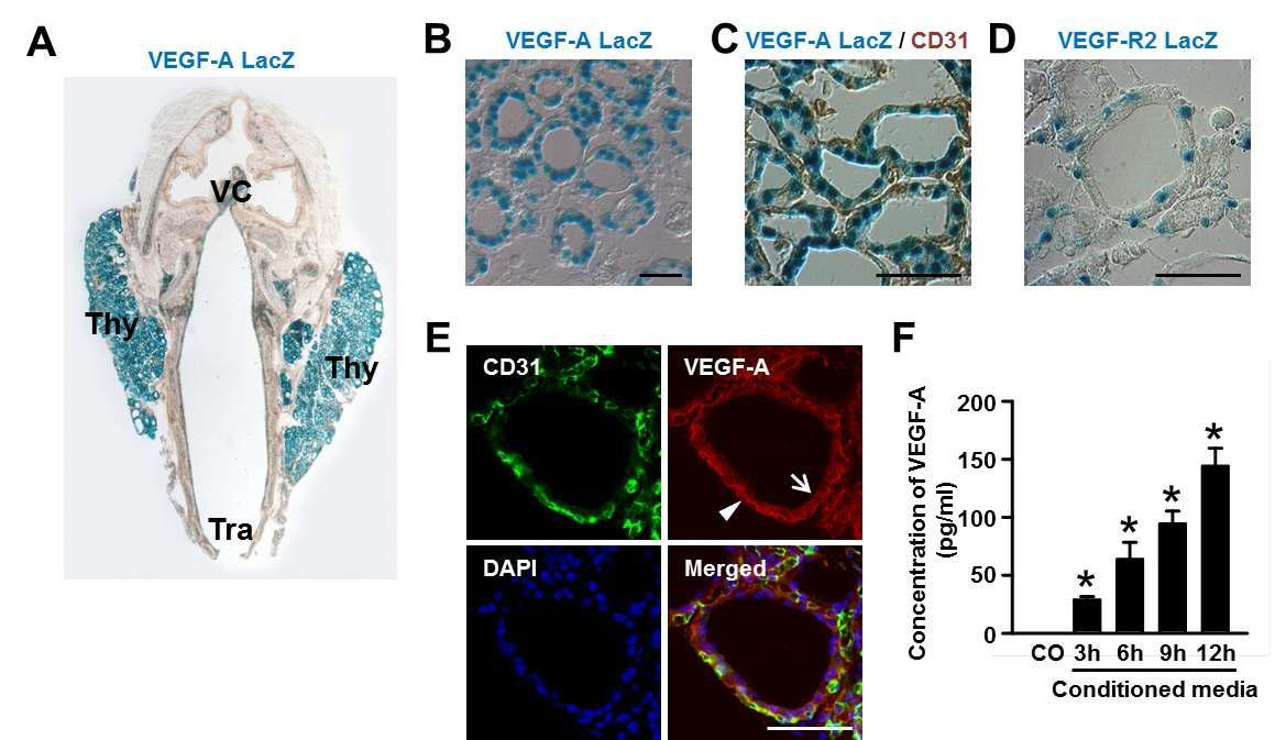 갑상선에서 VEGF-A의 발현 양상 규명. (A) VEGF-A+/LacZ 유전자 변형 마우스에서 X-gal 염색을 시행한 결과 갑상선에 특이적으로 VEGF-A 과발현하고 있는 양상을 발견하였다. (B and C) 갑상선 실질 세 포에 특이적으로 발현하는 VEGF-A의 양상을 X-gal 염색 및 CD31 표지자 DAB 면역염색을 통하여 확인하 였다. (D) VEGF-A의 수용체인 VEGF receptor2 는 갑상선 실질세포가 아닌 주변 혈관세포에 발현함을 VEGFR2+/LacZ 유전자 변형 마우스를 통하여 확인하였다. (E) VEGF-A 면역염색 (F) 갑상선에서 발현하는 VEGF-A가 분비되는 양상을 ex-vivo로 세포 배양액에서 VEGF-A ELISA를 통하여 확인하였다.