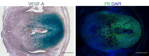 프로제스테론 수용체를 강하게 발현하는 자궁내막 기질세포들이 VEGF를 많이 생성하는 것을 관찰