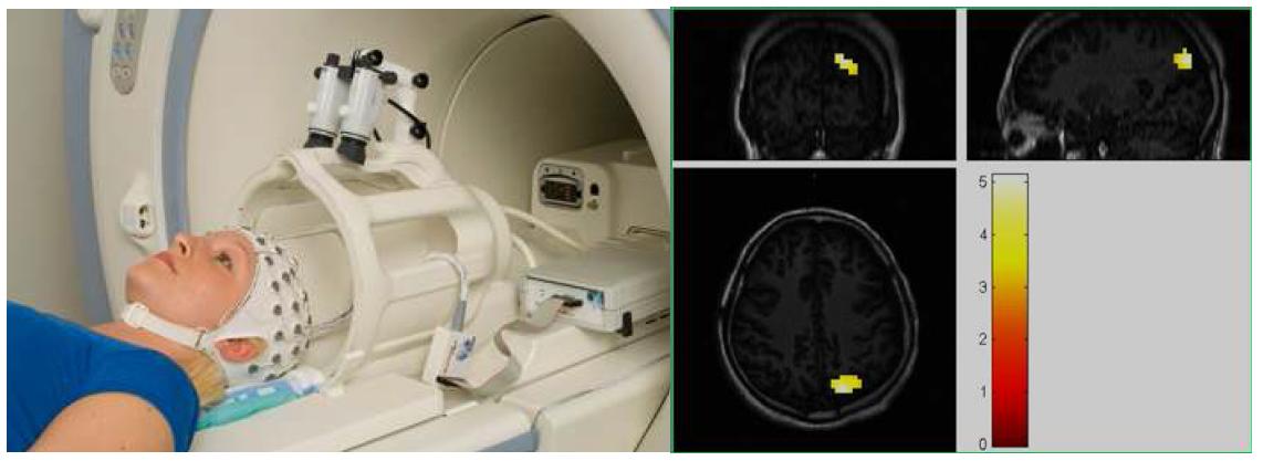 EEG-fMRI 동시 측정