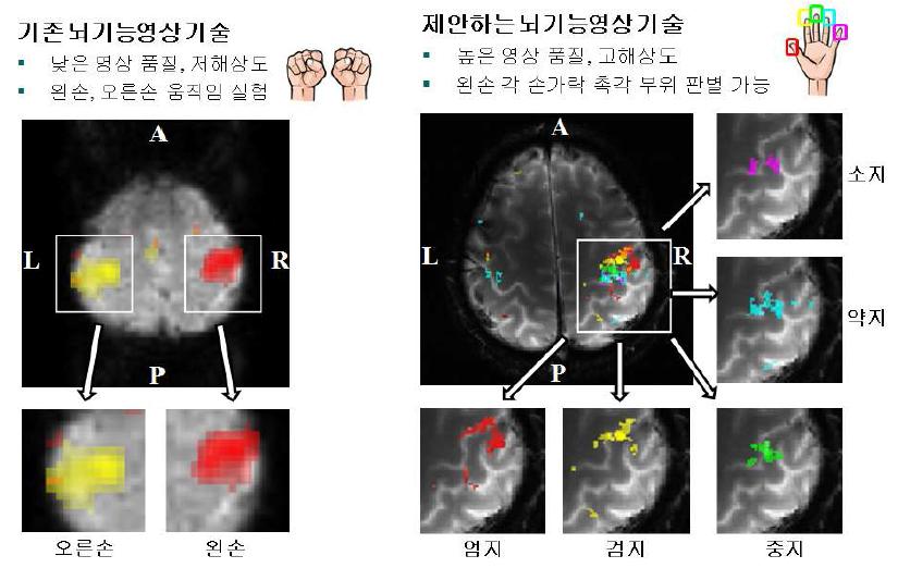 기존 방법과 제안하는 방법의 뇌기능 영상 결과