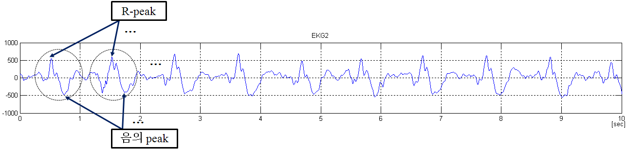 심장 박동의 신호