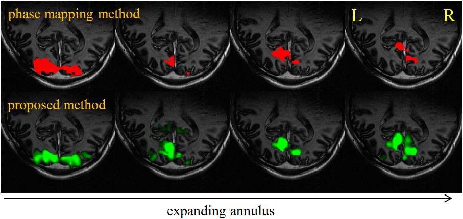 본 과제에서 개발된 방법으로 분석한 fMRI결과 영상