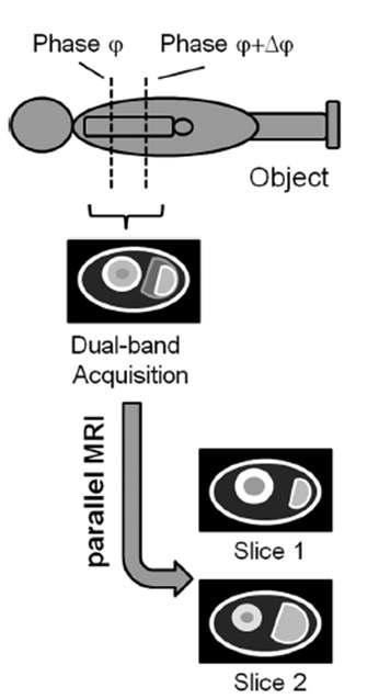 MB imaging을 위한 개념도