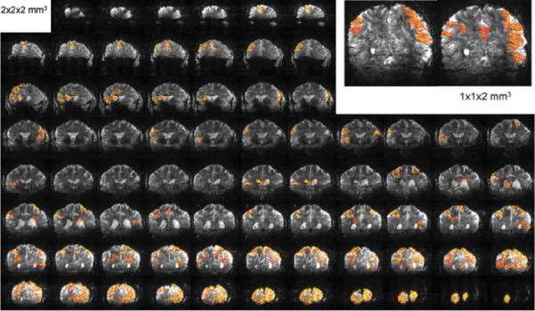 MB imaging 기법을 사용하여 뇌기능영상법에 적용한 결과