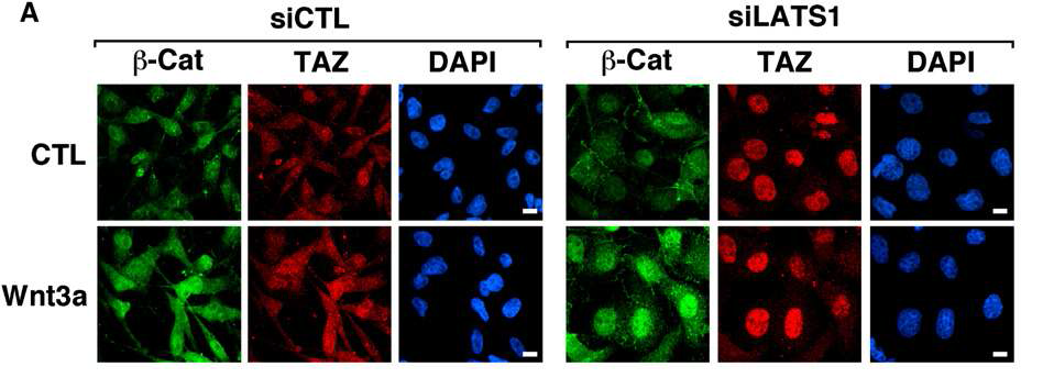 Abrogation of LATS1 expression induces TAZ nuclear accumulation and stimulates nuclear b-Catenin localization in response to Wnt3A. MDA-MB-231 세포주에 siCTL과 siLATS1을 처리하고 각각 control median와 Wnt3A-conditioned media에 2시간 처리한 후, endogenous TAZ와 b-Catenin의 localization을 조사함. siLATS1 처리한 세포에서 b-Catenin 핵내 localization이 증가함을 확인할 수 있음 (p < 0.0001).