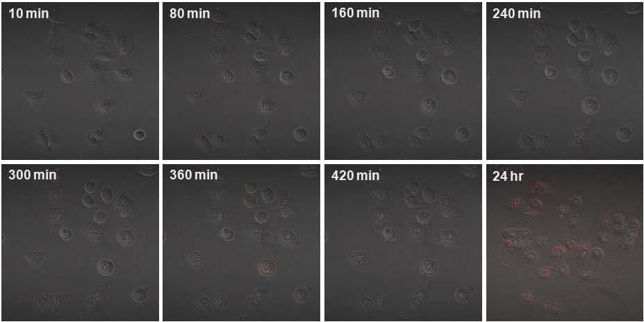 A549 셀과 실리카 전달체를 PBS 에서 24 h 관찰.