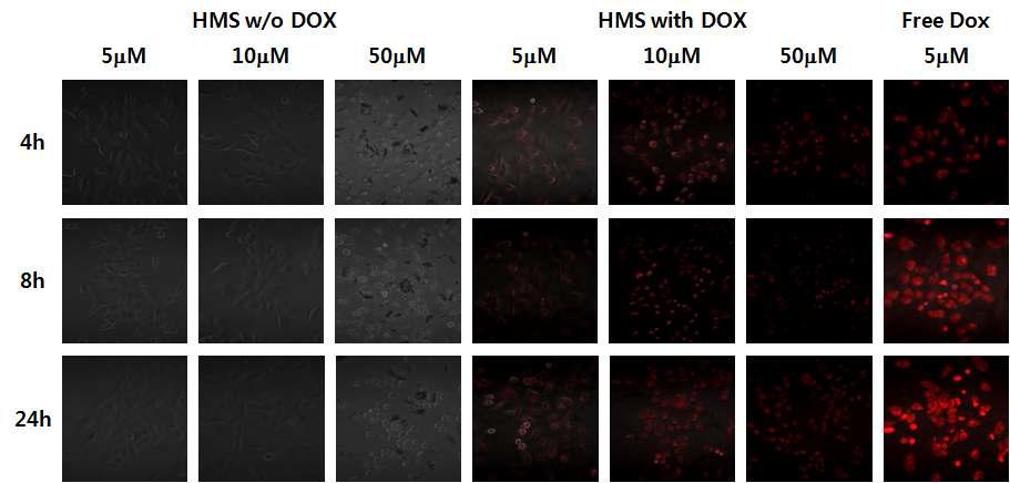 HMS-SS-CD-PEG와 HMS-SS-DOX-CD-PEG를 이용한 in vitro 실험.