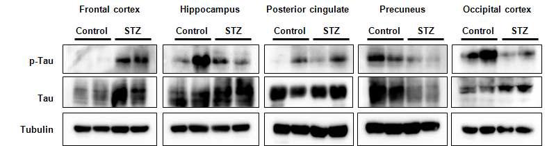 ICV-STZ를 투여한 cynomolgus brain의 brain 영역별 tau와 phosphorylated tau의 발현 양상