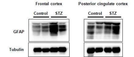 ICV-STZ를 투여한 cynomolgus brain의 cortex 영역에서 GFAP 단백질의 발현이 증가되어 있음을 확인함