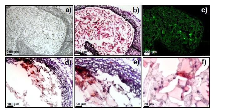 Tissue biocompatibility around the implant 31 days after subcutaneous injection of a PAL-PLX-PAL aqueous solution (0.5 mL) containing FITC-BSA into rats. Optical microscopic images (a), H&E stained images with different magnifications (b: x40, d: x100, e: x200, and f: x400), and fluorescence microscopic images (c) around the implant. g) Gel permeation chromatogram of the remaining gel 31 days after subcutaneous injection of the PAL-PLX-PAL aqueous solut ion into rats. Control is the raw PAL-PLX-PAL.