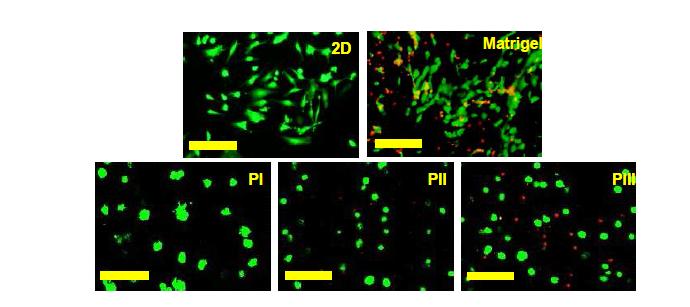 Comparison of the cell morphology in 28th day for 2D (culture dish) and 3D (PI, PII, PIII, and MatrigelTM in vitro cultured systems. The scale bar is 200 µm.