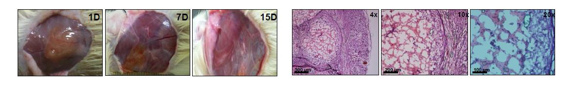 (좌)In vivo gel formation by subcutaneous injection of a PEG-PAF aqueous solution (10.0 wt.%, 0.5 mL) into rats. The photos around the implanted site were taken 1 day(1D), 7 days (7D), and 15 days (15D) after the subcutaneous injection. (우) Tissue biocompatibility around the implant 7days after subcutaneous injection of a PEG-PAF aqueous solution (10.0 wt.%, 0.5 mL) into rats. H&E stained images with different magnifications (a: x4, b: x10, c: x20) around the implant.