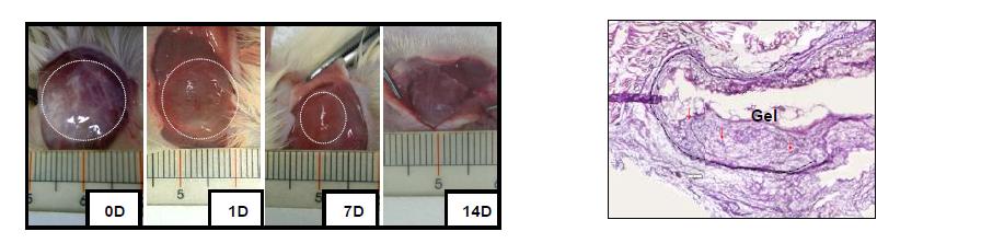 a) In situ gel formation and gel duration after subcutaneous injection of the CS-g-(PAF-PEG) aqueous solution (6.0 wt.%; 0.5 mL/rat) into rats. Photos around the implants (marked as white-dotted curves) were taken 6 hours (0 day), 1 day, 7 days, and 14 days after the injection. b) H & E stained image around the implanted gel 7 days after the injection. Arrows indicates vascular capillaries formed inside of the gel.