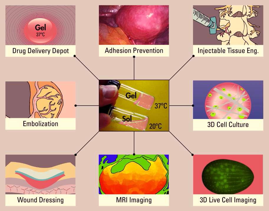 온도민감성 졸-젤 전이 고분자 수용액의 의학적 응용.