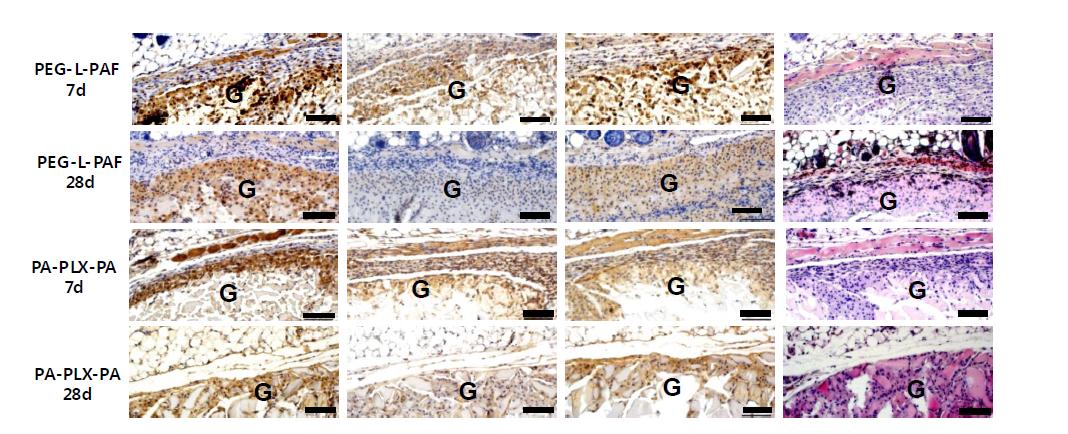 Histocompatibility around the implant 1, 3, 7, 14, 21, and 28days after subcutaneous injection of the in situ hydrogel into BALB/c mice. Optical microscopic images H&E stained images, imnunohistochemical stained by anti-CD68(general), CCR7(pro-inflammatory), CD163 (pro-healing). The scale bars are 100 mm.