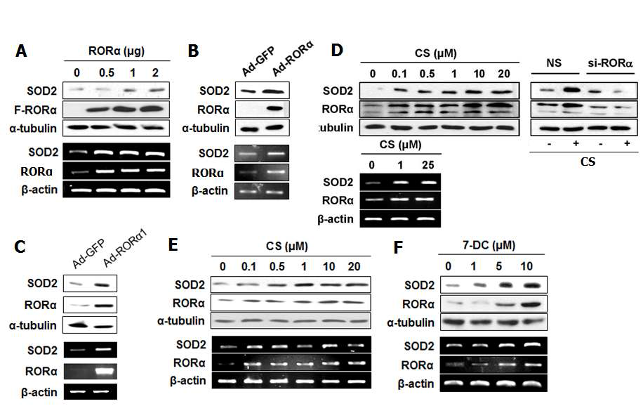 RORα에 의한 SOD2의 조절 (A) HepG2에서 RORα 과발현시 SOD2 발현 변화 (B) HepG2에서 RORα virus infection 후, SOD2 발현 변화 (C) Primary hepatocyte에서 RORα virus infection 후, SOD2 발현 변화 (D) HepG2에서 RORα 리간드인 CS를 농도 의존적으로 24 시간 처리 시, SOD2 발현 변화 / si-RORα를 transfection 시킨 후, CS 25 μΜ 처리시, SOD2 단백질 발현 변화 (E) Primary hepatocyte에서 RORα 리간드 CS와 7-DC 처리시 SOD2 발현 변화