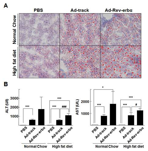 Safflower oil-enriched HFD 동물 모델에서 Rev-erbα 아데노바이러스에 의한 lipid droplet 형성 및 혈청 분석. C57BL/6N mouse에 Safflower oil-enriched HFD 식이를 한 후 Rev-erbα 아데노바이러스 처리시 (A) lipid droplet 형성 (B) 혈청 분석