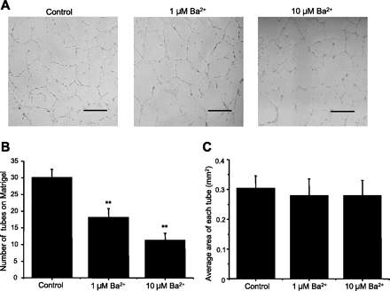 Potassium channel을 억제했을 때 세포분화가 억제