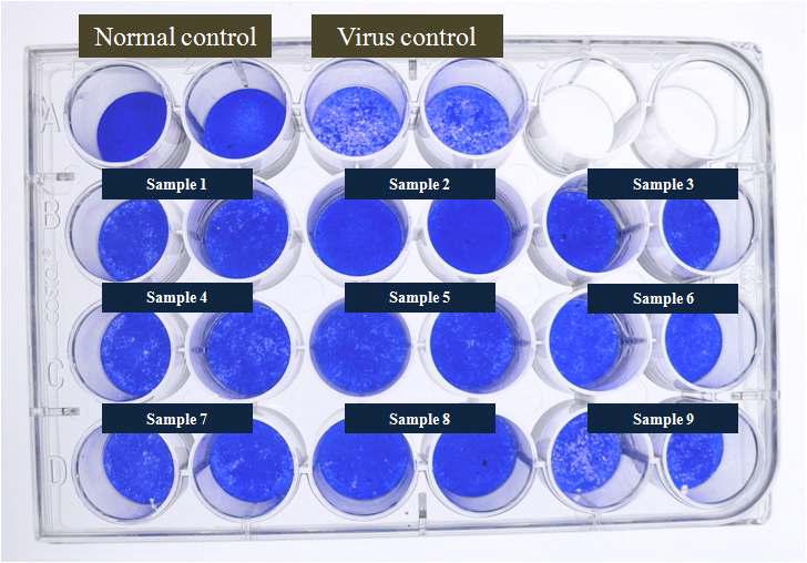 항코로나바이러스 활성 평가를 위한 Plaque reduction assay.