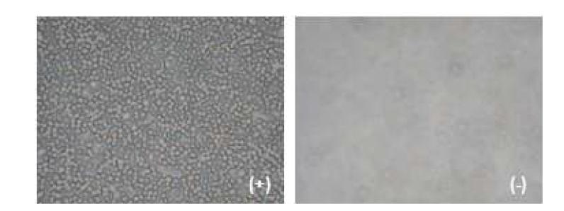 sVCAM-1 분자와 THP-1세포의 직접적인 결합 활성 (+: sVCAM-1 coating plate, -: BSA control)