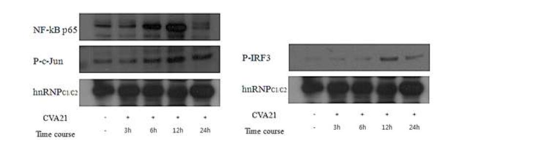 Coxsackievirus A21 감염에 의한 NF-kB, AP-1과 P-IRF3 발현
