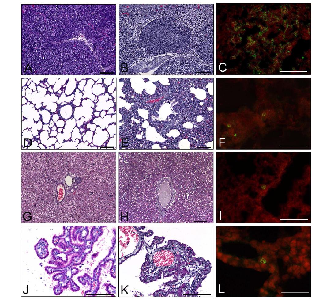 Histopathological findings and antigen distribution in the extra-intestinal organs of piglets inoculated with PRG942 (G9P[23]) strain. (A) Normal mesenteric lymph node (MLN) sampled from a mock-inoculated piglet showed intact cortex with densely concentrated lymphocytes (asterisk). (B) MLN sampled from a piglet inoculated with PRG942 (G9P[23]) strain at DPI 3 showed lymphoid cell depletion in the cortex (asterisk). (C) RVA-positive lymphoid cells (arrows) were scattered in the MLN from a piglet inoculated with PRG942 (G9P[23]) strain at DPI 3. (D) Normal lung tissue sampled from a mock-inoculated piglet had thin alveolar walls (arrows). (E) Lung tissue sampled from a piglet inoculated with PRG942 (G9P[23]) strain at DPI 3 showed interstitial pneumonia (arrows). (F) RVA antigens were detected in a pneumocyte (arrowhead) and lymphoid cell (arrow) in the lung from a piglet inoculated with PRG942 (G9P[23]) strain at DPI 3. (G) Normal liver sampled from a mock-inoculated piglet showed fat-stored hepatocytes (arrow). (H) Multiple necrotic hepatocytes scattered in the liver sampled from a piglet inoculated with PRG942 (G9P[23]) strain at DPI 3 showed pyknosis of nucleus and increased eosinophilia of cytoplasm (arrows). (I) RVA antigens were detected in a hepatocyte (arrow) in the liver from a piglet inoculated with PRG942 (G9P[23]) strain at DPI 3. (J) Intact epithelium (arrowheads) was observed in the choroid plexus sampled from a mock-inoculated piglet. (K) Choroid plexus sampled from a piglet inoculated with PRG942 (G9P[23]) strain at DPI 3 showed epithelial degeneration (arrowheads), necrosis (arrows), and lymphocyte infiltration (double arrows). (L) RVA antigens were detected in the epithelial cells (arrow) of the choroid plexus from a piglet inoculated with PRG942 (G9P[23]) strain at DPI 3. Bars A- L = 100 μm.