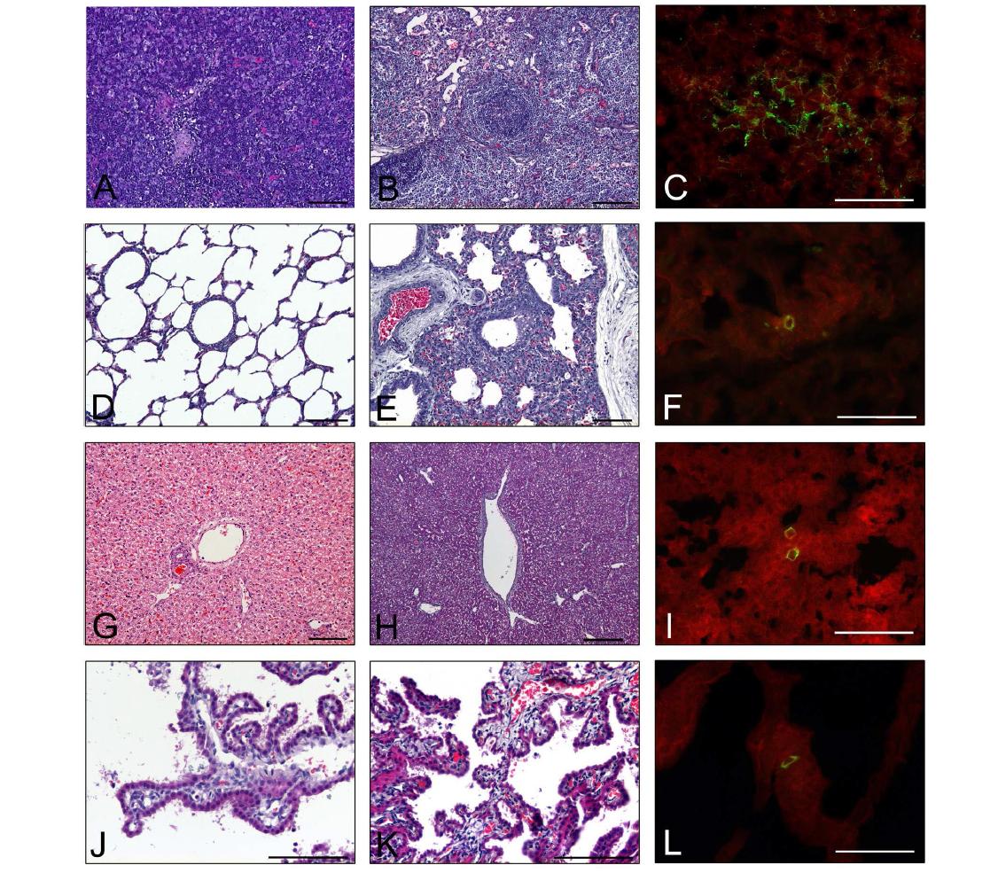 Histopathological findings and antigen distribution in the extra-intestinal organs of piglets inoculated with PRG9121 (G9P[7]) strain. (A) Normal mesenteric lymph node (MLN) sampled from a mock-inoculated piglet showed intact cortex with densely concentrated lymphocytes (asterisk). (B) MLN sampled from a piglet inoculated with PRG9121 (G9P[7]) strain at DPI 3 showed marked lymphoid cell depletion in the cortex (asterisk). (C) RVA-positive lymphoid cells (arrows) were scattered in the MLN from a piglet inoculated with PRG9121 (G9P[7]) strain at DPI 3. (D) Normal lung tissues sampled from a mock-inoculated piglet had thin alveolar walls (arrows). (E) Lung tissues sampled from a piglet inoculated with PRG9121 (G9P[7]) strain at DPI 3 showed interstitial pneumonia (arrows). (F) RVA antigen was detected in a pneumocyte (arrow) in the lung from a piglet inoculated with PRG9121 (G9P[7]) strain at DPI 3. (G) Normal liver sampled from a mock-inoculated piglet showed fat-stored hepatocytes (arrows). (H) Multiple necrotic hepatocytes scattered in the liver sampled from a piglet inoculated with PRG942 (G9P[23]) strain at DPI 3 showed pyknosis of nucleus and increased eosinophilia of cytoplasm (arrows). (I) RVA antigens were detected in a few hepatocytes (arrows) in the liver from a piglet inoculated with PRG9121 (G9P[7]) strain at DPI 3. (J) Intact epithelium (arrowheads) was observed in the choroid plexus sampled from a mock-inoculated piglet. (K) Choroid plexus sampled from a piglet inoculated with PRG9121 (G9P[7]) strain at DPI 3 showed epithelial degeneration (arrowheads), necrosis (arrows), and lymphocyte infiltration (double arrows). (L) RVA antigen was detected in a lymphoid cell (arrow) in the choroid plexus from a piglet inoculated with PRG9121 (G9P[7]) strain. Bars A- L = 100 μm.