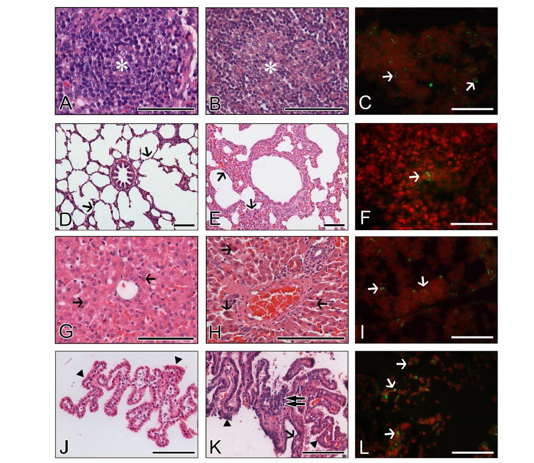Extra-intestinal histopathological changes and distribution of antigen-positive cells in piglets infected with porcine G5P[7] RVA strain K71. (A-C) Compared to densely packed lymphocytes (asterisk) in the cortex of normal mesenteric lymph node (MLN) from a mock-inoculated piglet (A), MLN from a virus-inoculated piglet showed lymphoid cell depletion (asterisk) in the cortex (B) and RVA antigen-positive cells (arrows) (C). (D-F) Lung sampled from a mock-inoculated piglet revealed normal thin alveolar wall (arrows) (D), whereas lung sampled from a virus-inoculated piglet showed interstitial pneumonia (arrows) (E) and RVA antigen-positive cells (arrow) (F). (G-I) Compared to normal fat-storing hepatocytes (arrows) from a mock-inoculated piglet (G), liver sampled from a virus-inoculated piglet showed multiple scattered necrotic hepatocytes (arrows) (H) and RVA antigen-positive cells (arrows) (I). (J-L) Choroid plexus sampled from a mock-inoculated piglet had intact epithelium (arrowheads) (J), whereas choroid plexus sampled from a virus-inoculated piglet displayed epithelial degeneration (arrowheads) and necrosis (arrows), and lymphoid cell infiltration (double arrow) into the tela choroidea (H), and RVA antigen-positive cells (arrows) (L). Hematoxylin and eosin stain (A, B, D, E, G, H, J, and K). Indirect immunofluorescence assay with monoclonal against the VP6 protein of strain OSU (C, F, I and L). Bars denote 100 μm.