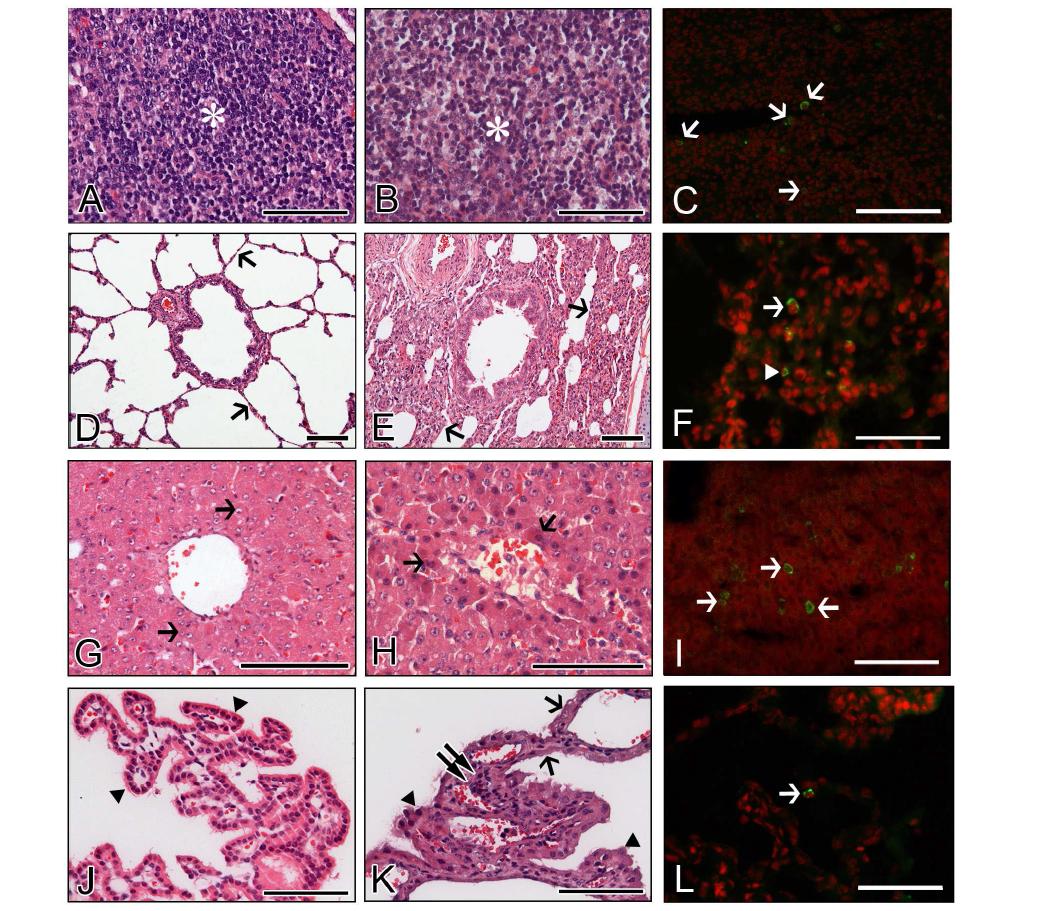 Extra-intestinal histopathological changes and distribution of antigen-positive cells in piglets infected with bovine G5P[7] RVA strain K5. (A-C) Compared to densely packed lymphocytes (asterisk) in the cortex of normal mesenteric lymph node (MLN) from a mock-inoculated piglet (A), MLN from a virus-inoculated piglet showed lymphoid cell depletion (asterisk) in the cortex (B) and RVA antigen-positive cells (arrows) (C). (D-F) Lung sampled from a mock-inoculated piglet revealed normal thin alveolar wall (arrows) (D), whereas lung sampled from a virus-inoculated piglet showed interstitial pneumonia (arrows) (E) and an RVA antigen-positive reaction in the pneumocyte (arrowhead) and lymphoid cell (arrow) (F). (G-I) Compared to normal fat-storing hepatocytes (arrows) from a mock-inoculated piglet (G), liver sampled from a virus-inoculated piglet showed multiple scattered necrotic hepatocytes (arrows) (H) and RVA antigen-positive cells (arrows) (I). (J-L) Choroid plexus sampled from a mock-inoculated piglet had intact epithelium (arrowheads) (J), whereas choroid plexus sampled from a virus-inoculated piglet displayed epithelial degeneration (arrowheads) and necrosis (arrows), and lymphoid cell infiltration (double arrow) into the tela choroidea (H), and RVA antigen-positive cells (arrow) (L). Hematoxylin and eosin stain (A, B, D, E, G, H, J, and K). Indirect immunofluorescence assay with monoclonal antibody against the VP6 protein of strain OSU (C, F, I, and L). Bars denote 100 μm.