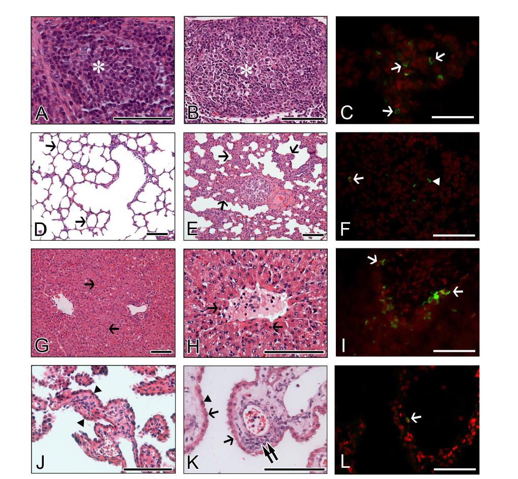 Extra-intestinal histopathological changes and distribution of antigen-positive cells in calves infected with bovine G5P[7] RVA strain K5. (A-C) Compared to densely packed lymphocytes (asterisk) in the cortex of normal mesenteric lymph node (MLN) from a mock-inoculated calf (A), MLN from a virus-inoculated calf showed lymphoid cell depletion (asterisk) in the cortex (B) and RVA antigen-positive cells (arrows) (C). (D-F) Lung sampled from a mock-inoculated calf revealed normal thin alveolar wall (arrows) (D), whereas lung sampled from a virus-inoculated calf showed interstitial pneumonia (arrows) (E) and RVA antigen-positive reaction in the pneumocyte (arrowhead) and lymphoid cell (arrow) (F). (G-I) Compared to normal hepatocytes (arrows) from a mock-inoculated calf (G), liver sampled from a virus-inoculated calf showed multiple scattered necrotic hepatocytes (arrows) (H) and RVA antigen-positive cells (arrows) (I). (J-L) Choroid plexus sampled from a mock-inoculated calf had intact epithelium (arrowheads) (J), whereas choroid plexus sampled from a virus-inoculated calf displayed epithelial degeneration (arrowhead) and necrosis (arrows), and lymphoid cell infiltration (double arrow) into the tela choroidea (H), and RVA antigen-positive cells (arrow) (L). Hematoxylin and eosin stain (A, B, D, E, G, H, J, and K). Indirect immunofluorescence assay with monoclonal antibody against the VP6 protein of strain OSU (C, F, I, and L). Bars denote 100 μm.