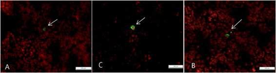 Antigen localization of rotaviruses; calf A-C Heterologous G5P[7] strain-inoculated calf. A -B. Lung sampled at PID(Post-inoculation day) 7 from calf inoculated with the heterolotous bovine rotavirus G5P[7] strain. C. Liver sampled at PID 7 from calf inoculated with the geterologous bovine rotavirus G5P[7]. A-B, 100㎛ C 200㎛.