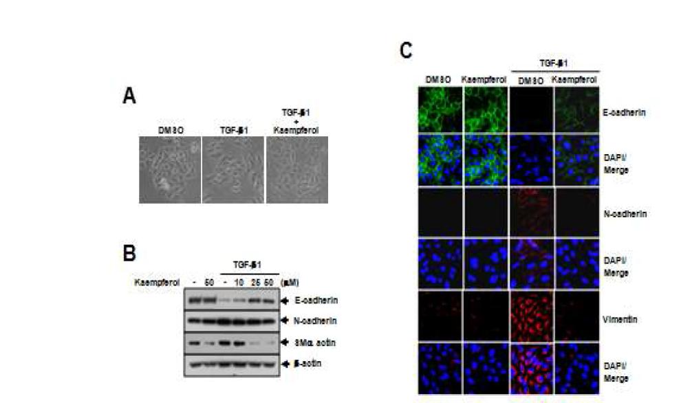 A549세포에서 kaempferol에 의한 TGF-β에 유도된 EMT 억제