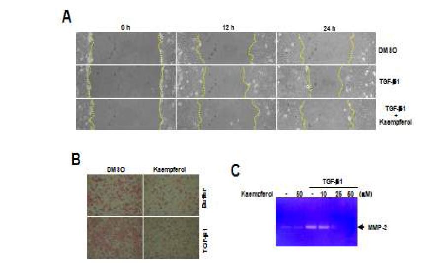 A549세포에서 TGF-β에 의한 암세포의 이동 및 MMP-3 발현에 있어서 kaempferol의 저해효과