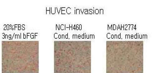 Cell invasion assay