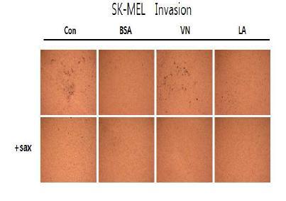 디스인테그린에 의한 cell migration저해