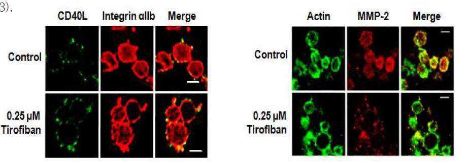 세포표면상 위치분석을 통한 세포외기질분해효소 MMP-2와 인테그린간 결합 확인과 Tirofiban에 의한 제어