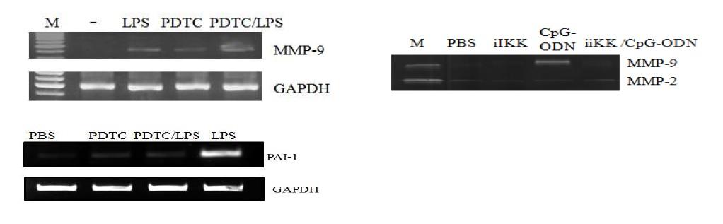 면역유도물질 LPS과 CpG-ODN에 의한 MMP-9, PAI-1, MMP-2의유도와 NF-KB 제어제와 IKK 제어제에 의한 제어 분석