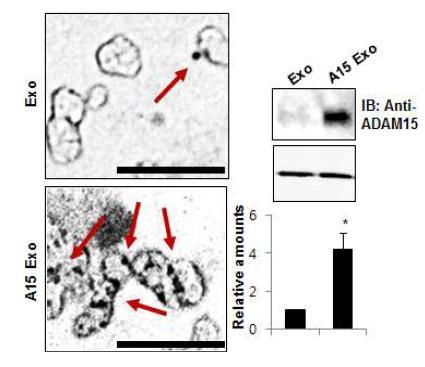 미세소낭성 ADAM15 (exsosomal ADAM15)의 전자현미경적하에서 형태관찰