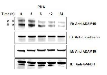 과발현벡터와 PMA에 의해 분비증가되는 미세소낭성 ADAM15과 다른 미세소낭성 단백질의 비교