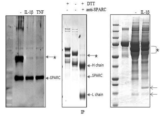 면역반응 유도물질 IL1b와 TNF에 의해 변화되는 신규인자 발견 (*)